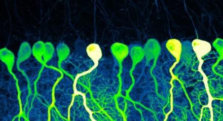 Dark Commute at 4am - First Place Photo Winner 2023. A confocal image of sparse GCaMP6f-expressing Purkinje cells in mouse cerebellum resembles the industrious contours of pre-dawn commuters.