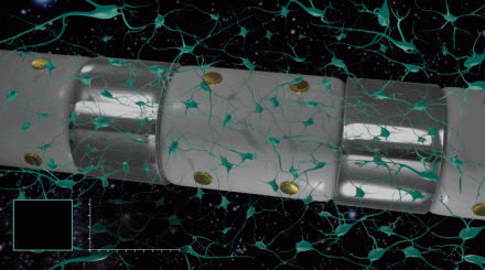 Neural probe punctuated with alternating macro-electrode and micro-electrode clusters that record local filed potential and single neuron spikes, respectively. Image credit: IEEE.