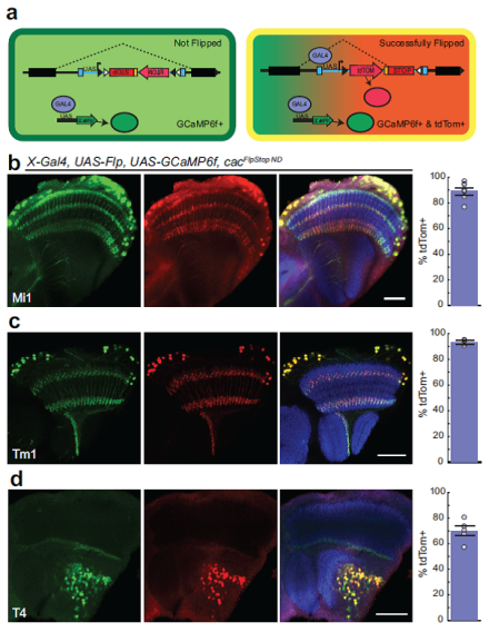 Dandinin brain images
