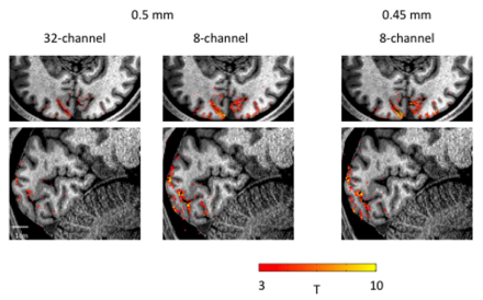 fMRI scans