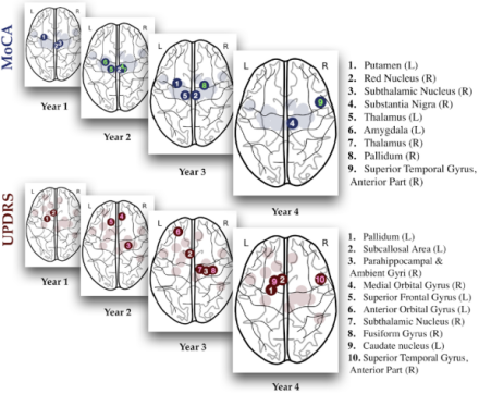 A deep learning neural network model predicts the emergence of salient regions involved in cognitive and motor impairments of Parkinson’s patients over four years.