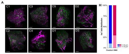 β cell distribution and innervation in the human pancreas.