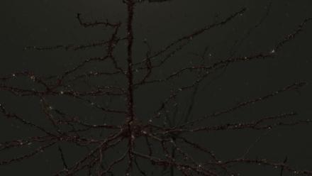 The Intersection of Memory and Memory  - Third Place Photo Winner 2022. Two memories captured under the microscope. Peering into the hippocampus of a mouse using viral technology and optogenetics.