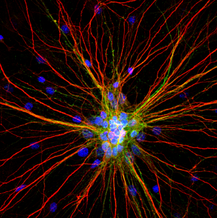 Radiating Neurons - Second Place Photo Winner 2020