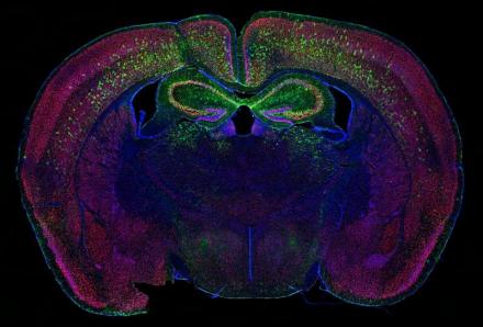 Microscopic image of mouse brain scan with fluorescent solor scheme - First Place Photo Winner 2021