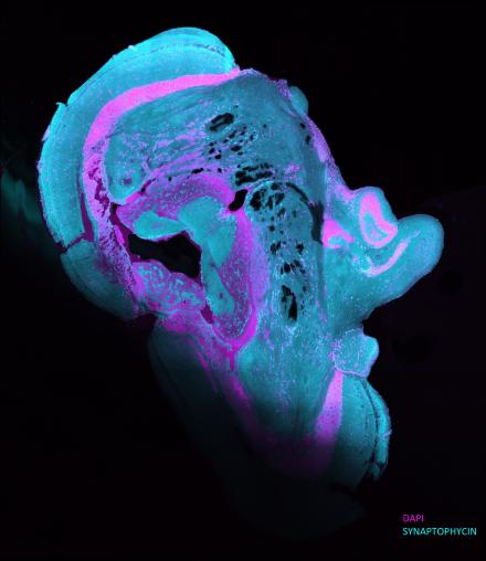 Zebrafish Brain Thinking Abraham Lincoln  - Third Place Photo Winner 2022. Image taken from Zebrafish brain tissue shows fluorescent blue and pink colors against a black background. The shape of the tissue section looks like Abraham Lincoln's side profile.