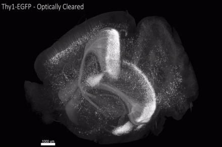 Intact whole-brain imaging of neurons