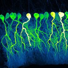 A confocal image of sparse GCaMP6f-expressing Purkinje cells in mouse cerebellum resembles the industrious contours of pre-dawn commuters.