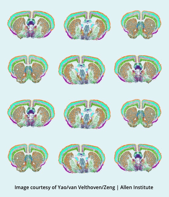 Section slices of a mouse brain colored to show the cell types throughout the brain.