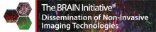 <img typeof="foaf:Image" class="img-responsive" src="https://braininitiative.nih.gov/sites/default/files/news_events/new-brain_imaging_banner_feb_1920_new.jpg" width="1920" height="400" alt="" />